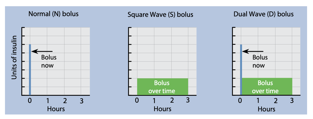 Bolus Types